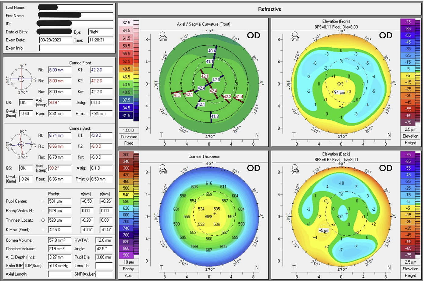 Laser 247: Cutting‑Edge Laser Solutions for Modern Manufacturing